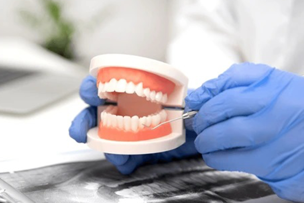 https://luxuriatedentalsolutions.com/wp-content/uploads/2025/01/luxuriate-dental-solution-teeth-replacement.jpg